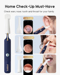 Bebird I35R ear cleaning camera for checking ears, nose, and oral health at home