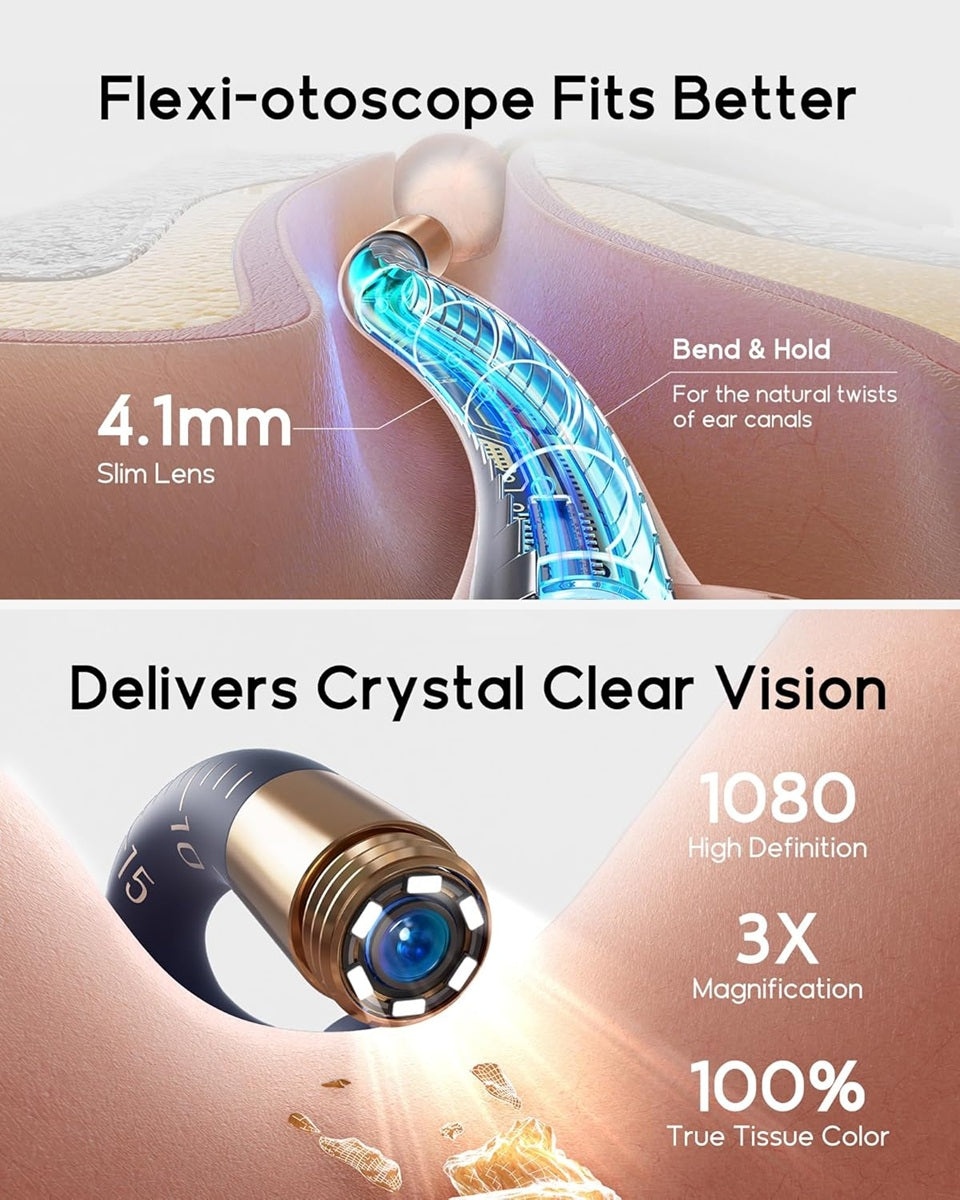 Bebird I35R ear cleaning camera with 4.1mm slim lens for crystal clear vision and 1080p high definition imaging