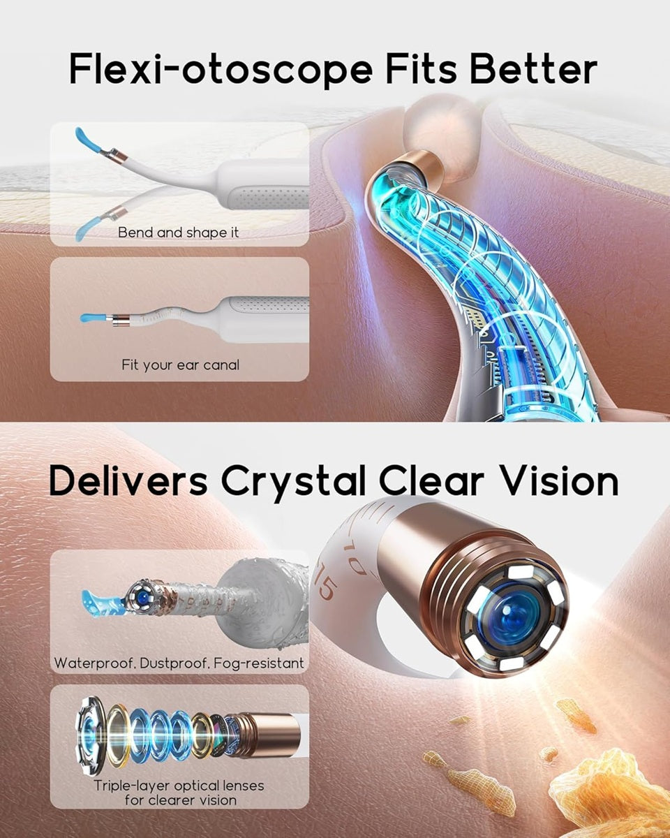 Bebird otoscope ear wax removal tool with flexi-otoscope for better fit and clear vision