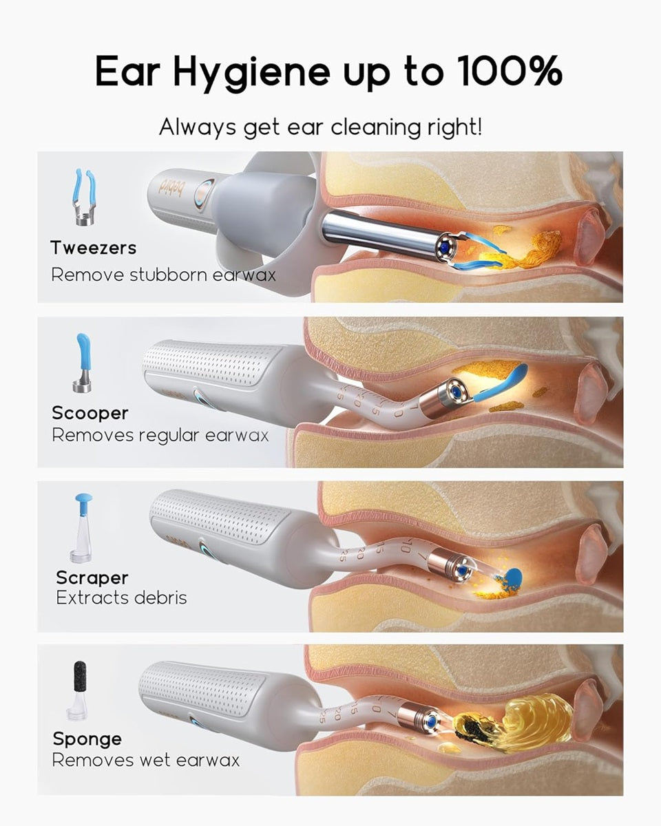 Bebird otoscope ear wax removal tool with various attachments for thorough ear hygiene